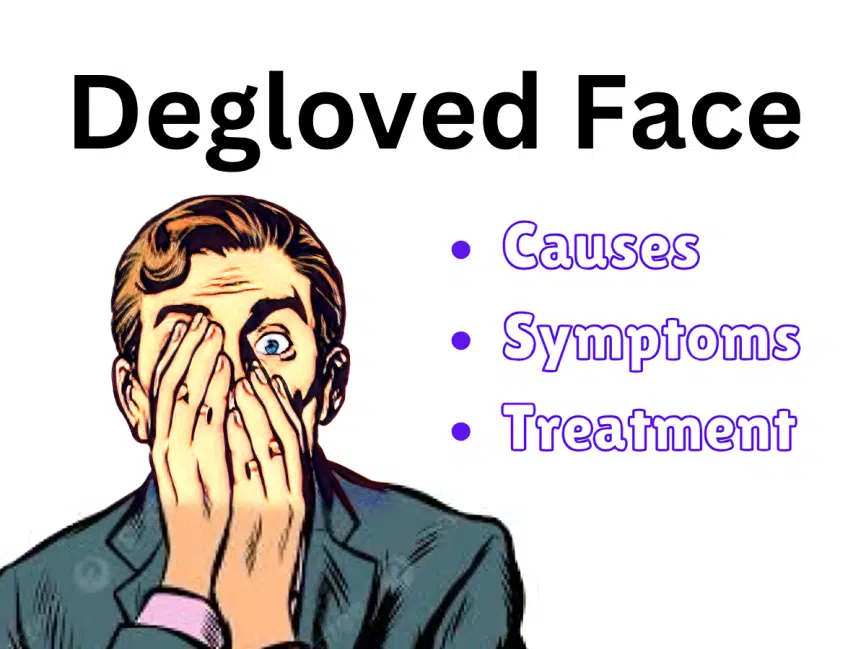 Degloved Face