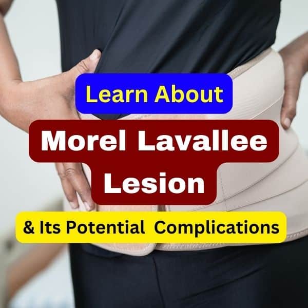 Morel Lavallee Lesion