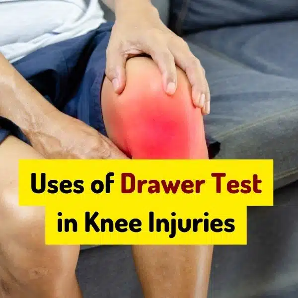 Uses of Drawer Test in Knee Injuries
