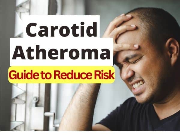carotid atheroma