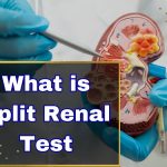 What is Split Renal Test