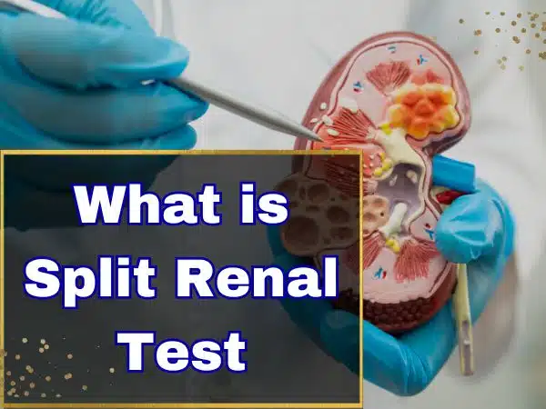 What is Split Renal Test